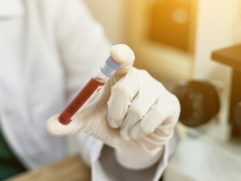 Prevention Screening AACI