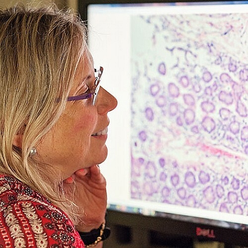 Aggressive Breast Cancers Store Large Amounts of Energy Enabling Them to Spread